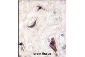 Formalin-fixed and paraffin-embedded human brain tissue reacted with RASGRF1 Antibody  (ABIN391841 and ABIN2841679) , which was peroxidase-conjugated to the secondary antibody, followed by DAB staining. (RASGRF1 antibody  (AA 907-936))