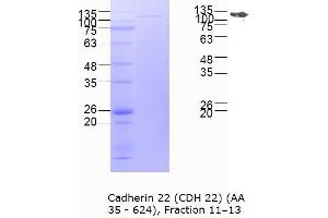 Western Blotting (WB) image for Cadherin-Like 22 (CDH22) (AA 35-624) protein (MBP tag) (ABIN3090216) (CDH22 Protein (AA 35-624) (MBP tag))