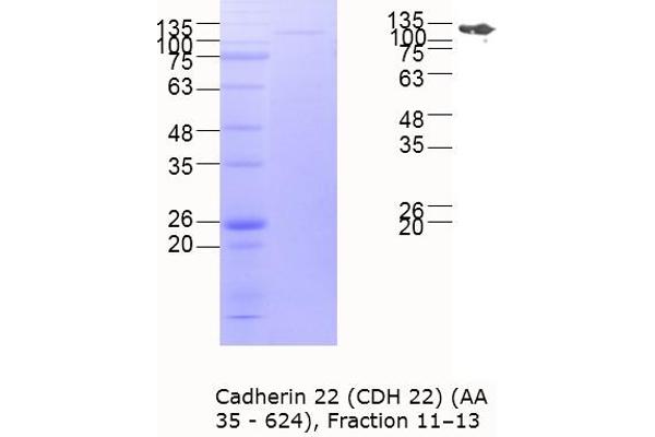 CDH22 Protein (AA 35-624) (MBP tag)