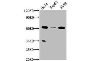 Western Blot Positive WB detected in: Hela whole cell lysate, HepG2 whole cell lysate, A549 whole cell lysate All lanes: MSS51 antibody at 4 μg/mL Secondary Goat polyclonal to rabbit IgG at 1/50000 dilution Predicted band size: 52, 27, 11 kDa Observed band size: 52 kDa (ZMYND17 antibody  (AA 258-365))