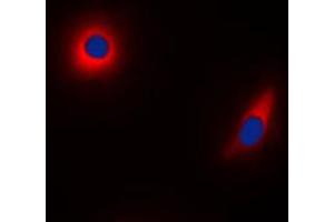Immunofluorescent analysis of NDUFS1 staining in HeLa cells.