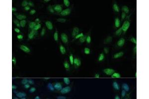 Immunofluorescence analysis of U2OS cells using SMAD7 Polyclonal Antibody at dilution of 1:100. (SMAD7 antibody)