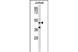 Western blot analysis in Jurkat cell line lysates (35ug/lane). (RBM22 antibody  (AA 165-193))