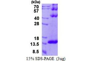 Image no. 1 for Dynein, Light Chain, Tctex-Type 3 (DYNLT3) protein (His tag) (ABIN1098381) (DYNLT3 Protein (His tag))