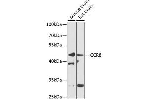 Western blot analysis of extracts of various cell lines, using CCR8 antibody (ABIN6130010, ABIN6138101, ABIN6138102 and ABIN6224067) at 1:1000 dilution. (CCR8 antibody  (AA 296-355))