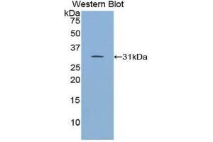 Western Blotting (WB) image for anti-Inhibitor of KB Kinase beta Interacting Protein (IKbIP) (AA 80-315) antibody (ABIN1859321)