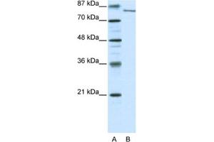 Western Blotting (WB) image for anti-Lysine (K)-Specific Demethylase 2A (KDM2A) antibody (ABIN2460277) (KDM2A antibody)