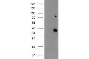 HEK293T cells were transfected with the pCMV6-ENTRY control (Left lane) or pCMV6-ENTRY ELAVL1 (Right lane) cDNA for 48 hrs and lysed. (ELAVL1 antibody)