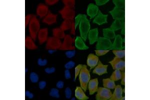 ABIN7096942 and ABIN7101008 staining Hela cells(30 min of UV treatment) by IF/ICC. (C22orf9 antibody)