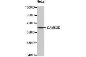 Western Blotting (WB) image for anti-Calcium/calmodulin-Dependent Protein Kinase II delta (CAMK2D) antibody (ABIN1871415) (CAMK2D antibody)