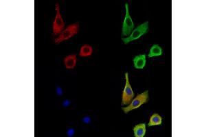 ABIN7094881 and ABIN7098934 staining Hela cells by IF/ICC.