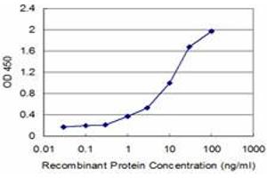 Detection limit for recombinant GST tagged IL1B is approximately 0. (IL-1 beta antibody  (AA 170-269))