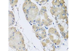 Immunohistochemistry of paraffin-embedded Human stomach using RPLP1 Polyclonal Antibody at dilution of 1:100 (40x lens). (RPLP1 antibody)