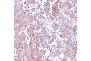 Immunohistochemical staining of human liver tissue with ELOVL7 polyclonal antibody  at 5 ug/mL dilution. (ELOVL7 antibody  (N-Term))