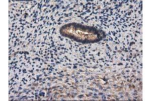 Image no. 9 for anti-Destrin (Actin Depolymerizing Factor) (DSTN) antibody (ABIN1497910) (Destrin antibody)