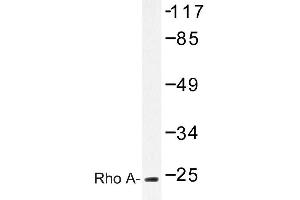 Image no. 1 for anti-Ras Homolog Gene Family, Member A (RHOA) antibody (ABIN272117) (RHOA antibody)