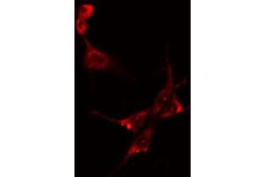 ABIN6274151 staining Hela cells by IF/ICC. (CKM antibody  (N-Term))