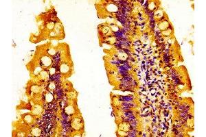 IHC image of ABIN7151890 diluted at 1:500 and staining in paraffin-embedded human small intestine tissue performed on a Leica BondTM system. (EPS8-Like 3 antibody  (AA 367-521))