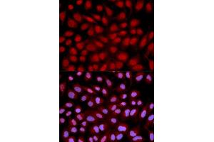 Immunofluorescence (IF) image for anti-Nuclear Factor of Activated T-Cells, Cytoplasmic, Calcineurin-Dependent 1 (NFATC1) (AA 20-300) antibody (ABIN3022101)