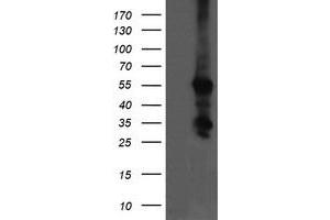 Image no. 3 for anti-Chaperonin Containing TCP1, Subunit 8 (Theta)-Like 2 (CCT8L2) antibody (ABIN1497480) (CCT8L2 antibody)