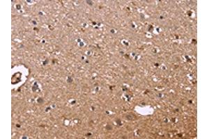 The image on the left is immunohistochemistry of paraffin-embedded Human brain tissue using ABIN7130954(S100A13 Antibody) at dilution 1/40, on the right is treated with fusion protein. (S100A13 antibody)