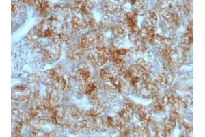 Image no. 1 for anti-Cadherin-16 (CDH16) antibody (ABIN6182923) (Cadherin-16 antibody)
