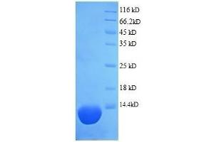 Complement Component 5 (C5) (AA 1-74), (full length) protein (His tag) (C5 Protein (AA 1-74, full length) (His tag))