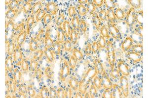 ABIN6261431 and ABIN6279416 at 1/100 staining Rat kidney tissue by IHC-P.