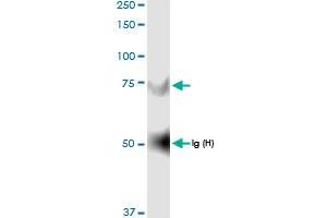 Immunoprecipitation of GNPAT transfected lysate using anti-GNPAT MaxPab rabbit polyclonal antibody and Protein A Magnetic Bead , and immunoblotted with GNPAT MaxPab rabbit polyclonal antibody (D01) . (GNPAT antibody  (AA 1-680))
