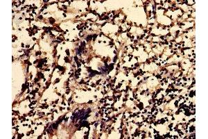 IHC image of ABIN7163135 diluted at 1:600 and staining in paraffin-embedded human appendix tissue performed on a Leica BondTM system. (Sphingomyelin Synthase 2 antibody  (AA 1-79))