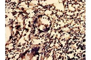 IHC image of ABIN7163135 diluted at 1:600 and staining in paraffin-embedded human appendix tissue performed on a Leica BondTM system.