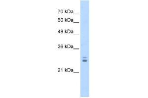 KCTD11 antibody used at 1. (KCTD11 antibody  (N-Term))