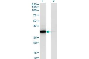 Western Blot analysis of ATP6V1E1 expression in transfected 293T cell line by ATP6V1E1 monoclonal antibody (M02), clone 4E11. (ATP6V1E1 antibody  (AA 1-226))