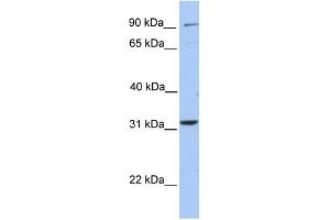 ELFN2 antibody used at 1 ug/ml to detect target protein. (ELFN2 antibody  (N-Term))