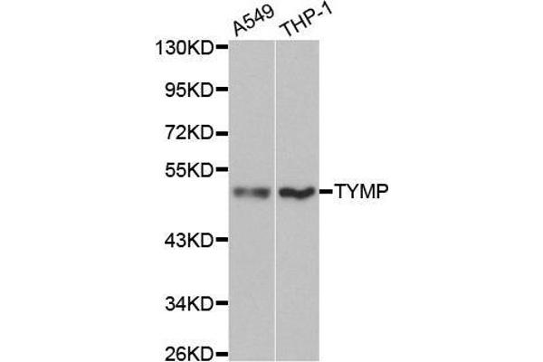 Thymidine Phosphorylase antibody  (AA 1-200)