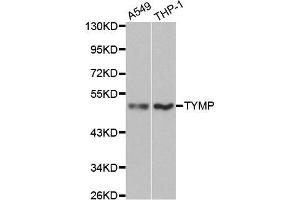 Western blot analysis of extracts of various cell lines, using TYMP antibody. (Thymidine Phosphorylase antibody  (AA 1-200))