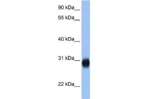 WB Suggested Anti-RAB3D Antibody Titration:  2. (RAB3D antibody  (C-Term))