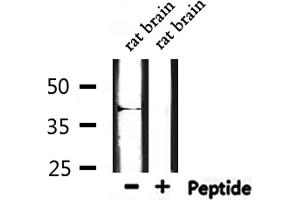 Western blot analysis of extracts from rat brain, using MT-CYB Antibody. (Cytochrome b antibody  (N-Term))