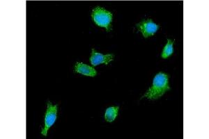 IF analysis of DDX6 using anti-DDX6 antibody (ABIN7602043). (DDX6 antibody  (AA 56-483))