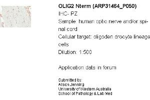 Sample Type: Human Optic Nerve and Spinal CordCellular Target: Oligoden Drocyte Lineage CellsDilution: 1:500 (OLIG2 antibody  (N-Term))