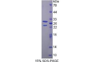 Image no. 1 for BMX Non-Receptor Tyrosine Kinase (BMX) (AA 287-523) protein (His tag) (ABIN4991064) (BMX Protein (AA 287-523) (His tag))