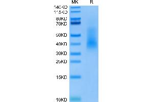 Human Rankl on Tris-Bis PAGE under reduced condition. (RANKL Protein (AA 63-244) (His-DYKDDDDK Tag))