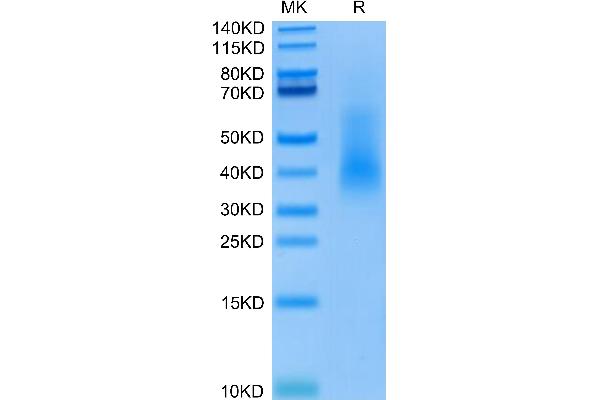 RANKL Protein (AA 63-244) (His-DYKDDDDK Tag)