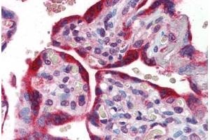 Human Placenta: Formalin-Fixed, Paraffin-Embedded (FFPE) (ABCB4 antibody  (AA 252-301))