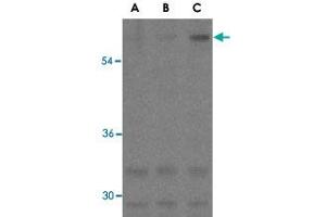 Western blot analysis of ANTXR1 in K-562 cell lysates with ANTXR1 polyclonal antibody  at (A) 0. (ANTXR1 antibody)