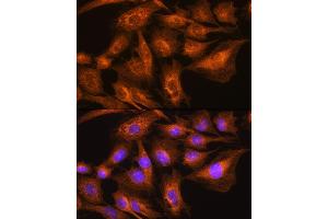 Immunofluorescence analysis of C6 cells using Apolipoprotein  Rabbit pAb (ABIN7265634) at dilution of 1:100. (APOA2 antibody  (AA 1-100))