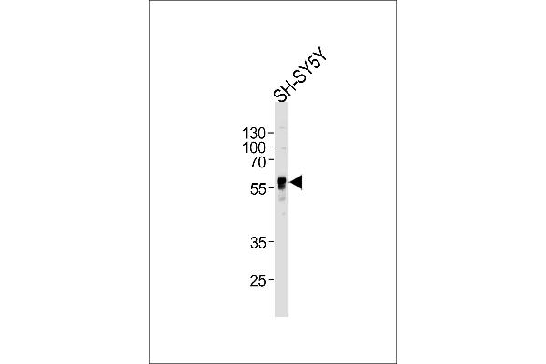 ABHD3 antibody  (C-Term)