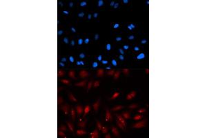 Immunofluorescence analysis of U2OS cells using PA2G4 antibody (ABIN5973112). (PA2G4 antibody)