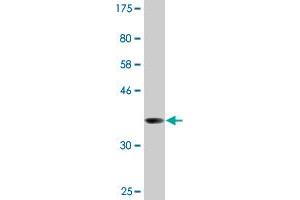 Western Blot detection against Immunogen (37. (RBM10 antibody  (AA 123-230))