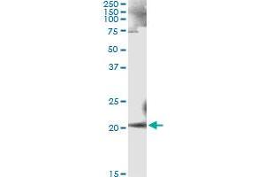 Immunoprecipitation of ANK1 transfected lysate using anti-ANK1 monoclonal antibody and Protein A Magnetic Bead , and immunoblotted with ANK1 MaxPab rabbit polyclonal antibody. (Erythrocyte Ankyrin antibody  (AA 1-155))